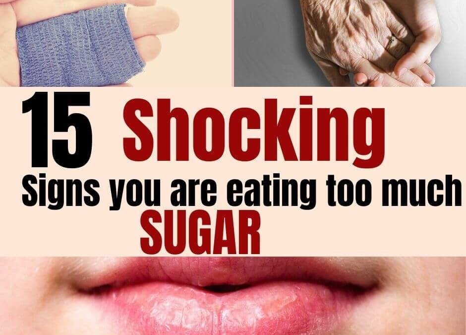 15 Shocking Signs You’re Eating Too Much Sugar